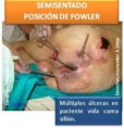 /album/fotogaleria/foto-5-semisentado-posicion-de-fowler-1-jpg/